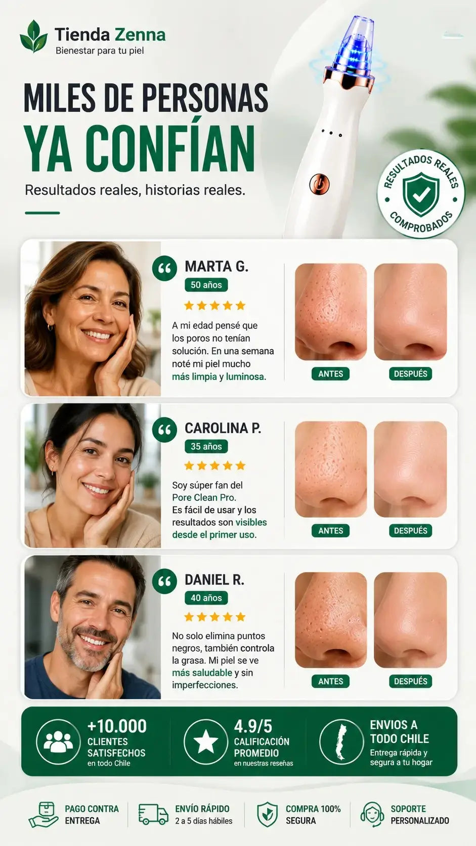 Aspirador facial para limpieza de poros - PoreClean Pro